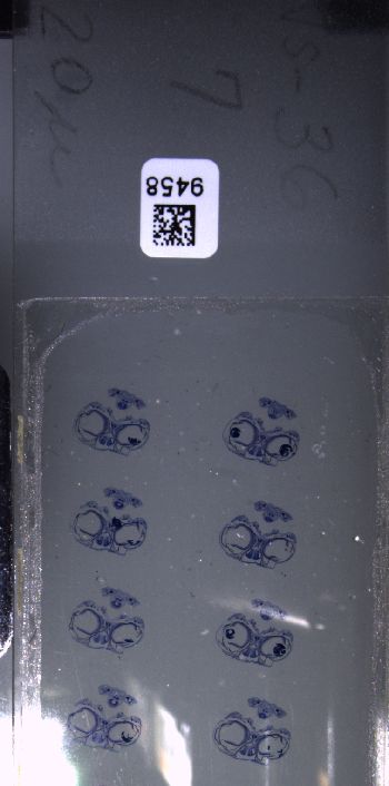 Media type: image; Special Collections 3102   shows specimen_part histological serial section;  Description: Whole slide scan, SC-3102, slide 7;
